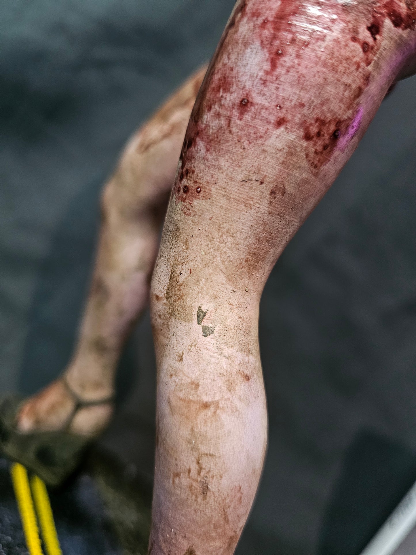 1/6 Silent Hill Lying Figure